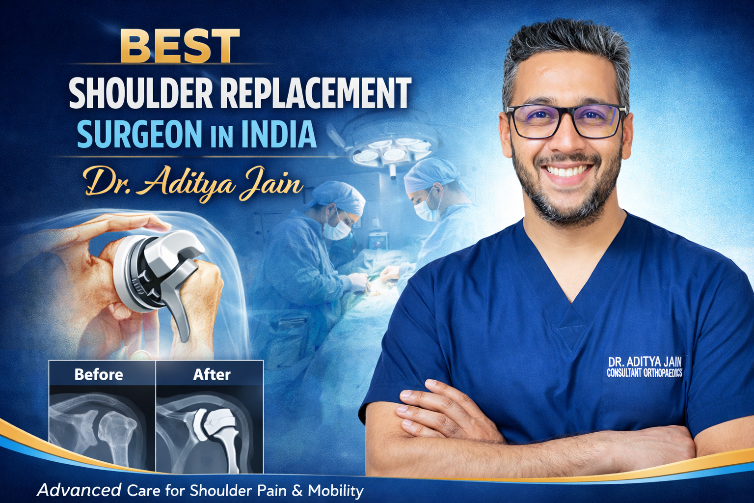 Best Shoulder Replacement Surgeon in India